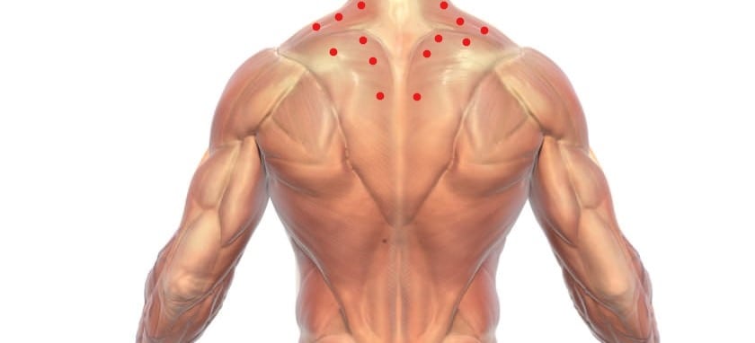 trigger points in the back