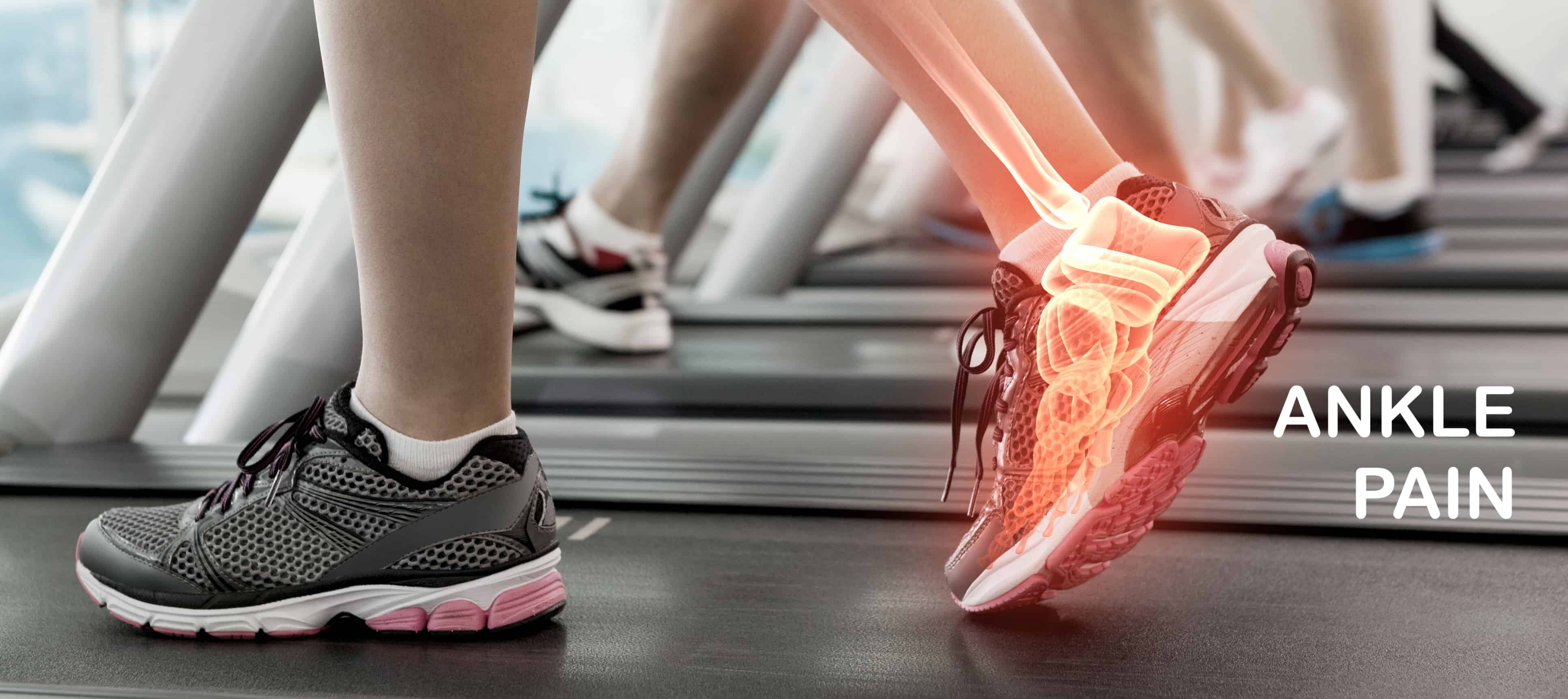 Ankle Pain Relief for Runners - Custom Chiropractor